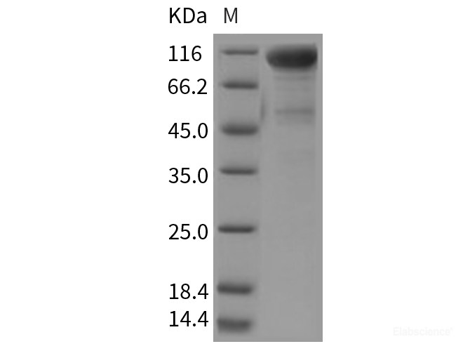 Recombinant Rat DDR2 Kinase / CD167b Protein (Fc tag)-Elabscience