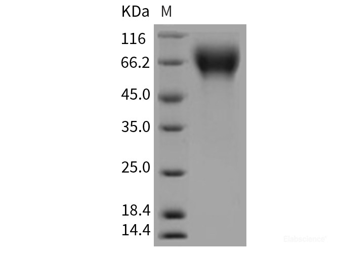 Recombinant Rat CD6 / TP120 Protein (His tag)-Elabscience