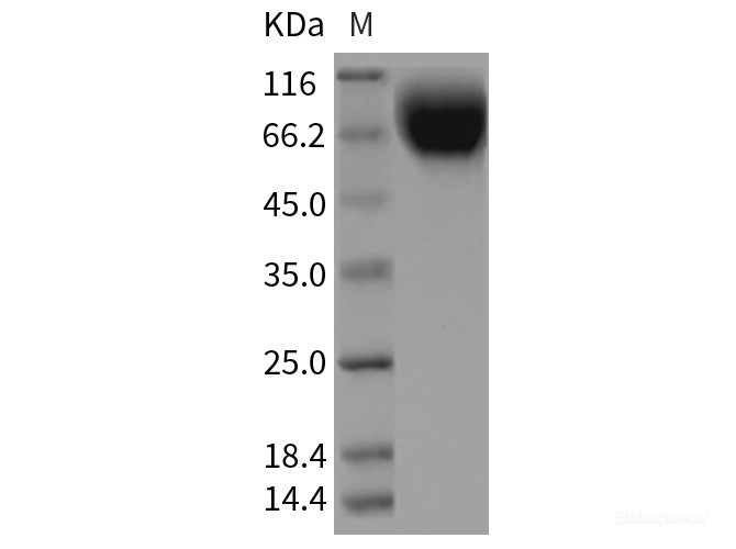 Recombinant Rat SIRP alpha / CD172a Protein (His tag)-Elabscience
