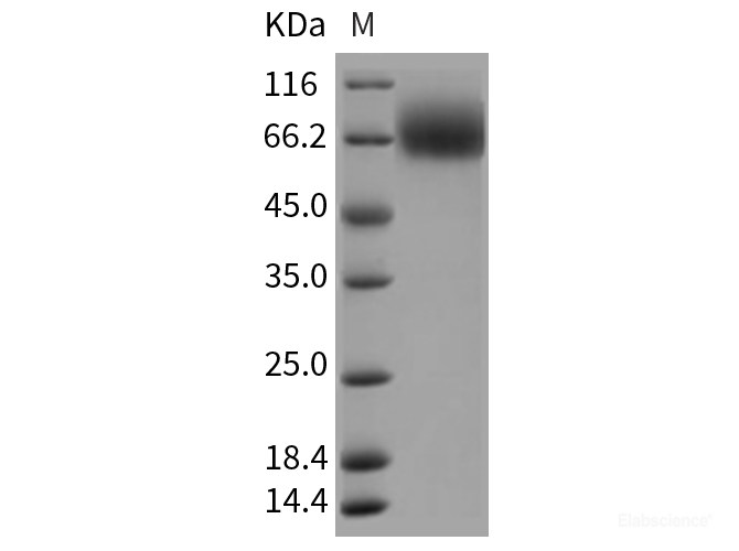 Recombinant Rat TrkB / NTRK2 Protein (His tag)-Elabscience