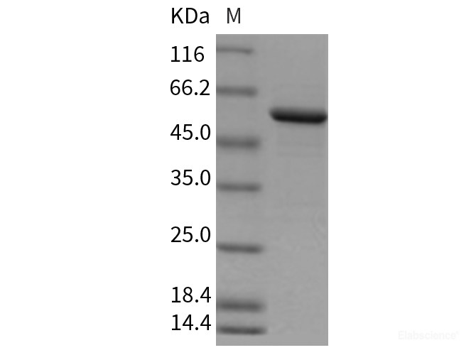 Recombinant Rat Galectin-8 / LGALS8 Protein (GST tag)-Elabscience