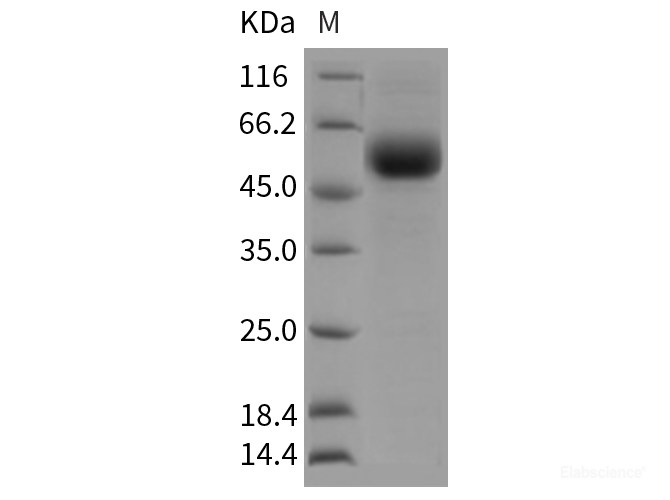 Recombinant Rat TGFBR2 Protein (Fc tag)-Elabscience
