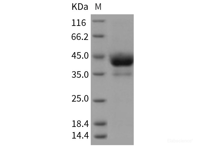 Recombinant Rat ACVR1B / ALK-4 Protein (Fc tag)-Elabscience