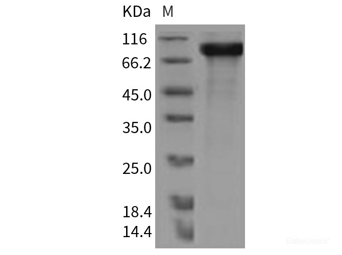 Recombinant Rat HER4 / ErbB4 Protein (His tag)-Elabscience