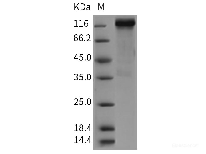 Recombinant Rat HER4 / ErbB4 Protein (Fc tag)-Elabscience