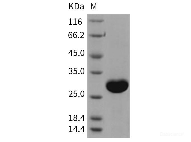 Recombinant Rat UCHL1 / PGP9.5 Protein (His tag)-Elabscience