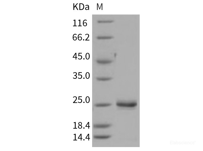 Recombinant Rat LCN2 / NGAL Protein (His tag)-Elabscience