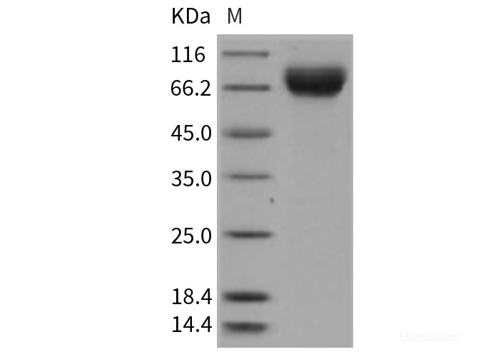 Recombinant Rat E-Selectin / CD62e / SELE Protein (His tag)-Elabscience