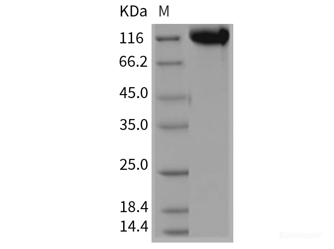 Recombinant Rat E-Selectin / CD62e / SELE Protein (Fc tag)-Elabscience