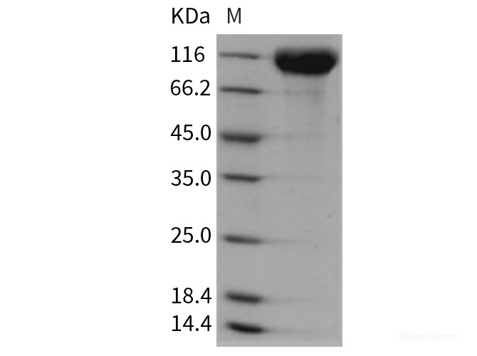 Recombinant Rat ACE2 / Angiotensin-Converting Enzyme 2 Protein (His tag)-Elabscience