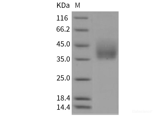 Recombinant Rat Growth Hormone Receptor / GHR / GHBP Protein (His tag)-Elabscience