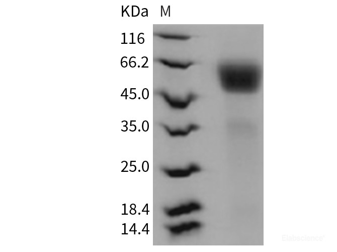 Recombinant Rat IL1R1 / CD121a Protein (His tag)-Elabscience