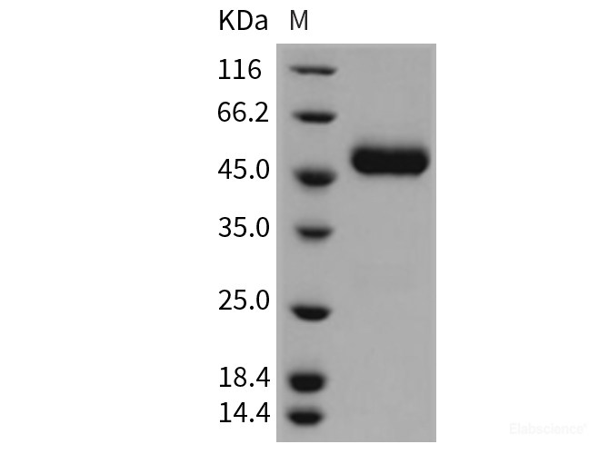 Recombinant Rat CNTFR / CNTFR-alpha Protein (His tag)-Elabscience