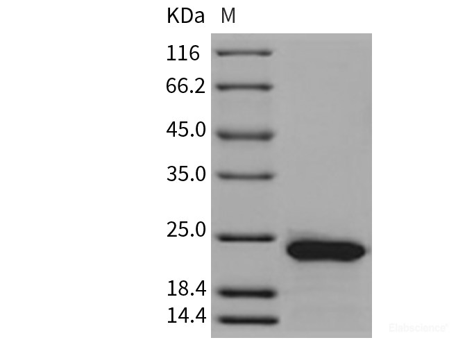 Recombinant Rat RBP4 Protein (His tag)-Elabscience