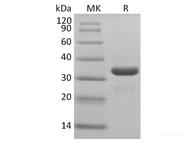 Recombinant 2019-nCoV 3C-like Proteinase Protein (His Tag)(Active)
