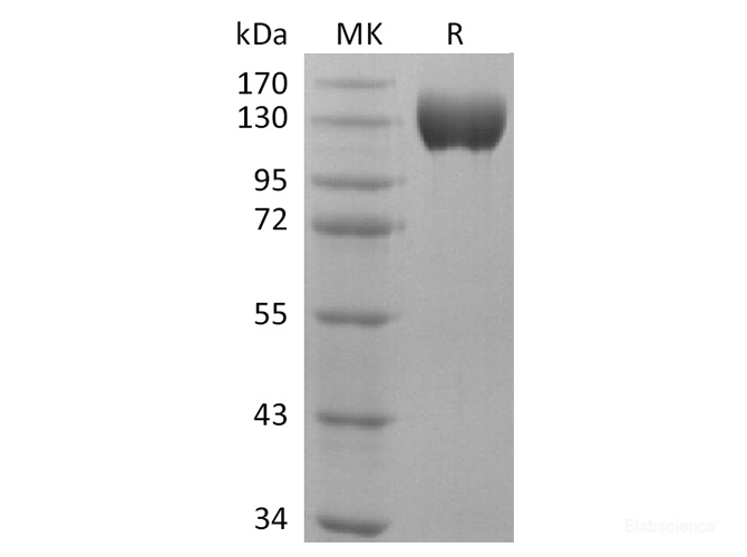 Recombinant Human ACE2 Protein (Fc Tag)