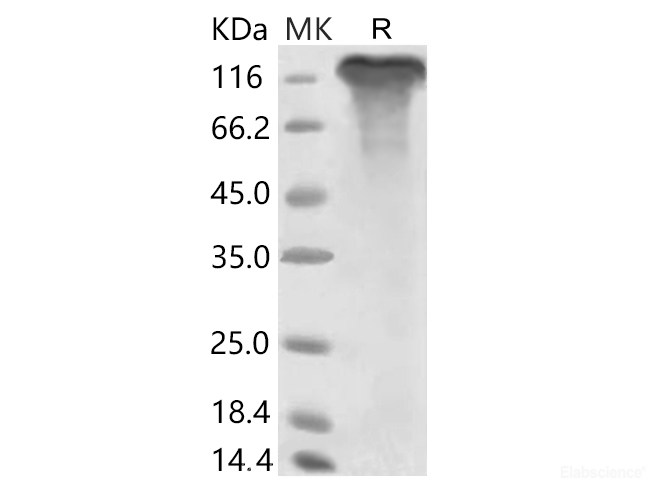 Recombinant 2019-nCoV S1 Protein (Fc Tag)(Active)