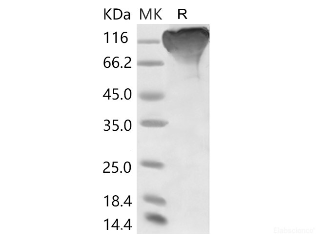 Recombinant 2019-nCoV S1 Protein (mFc Tag)(Active)
