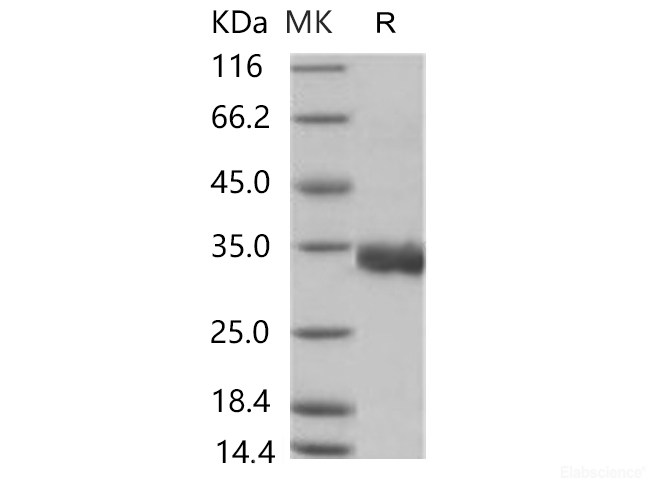 Recombinant 2019-nCoV Spike/RBD Protein (RBD, His Tag)