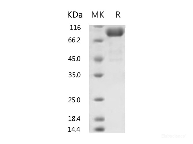 Recombinant Human ACE2 Protein (His Tag)-Elabscience