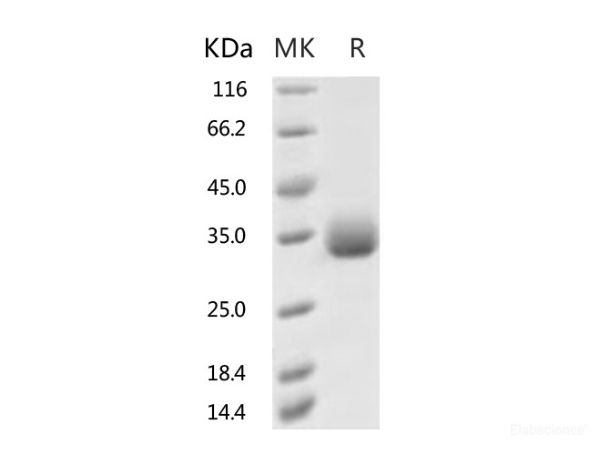 Recombinant 2019-nCoV Spike Protein (RBD, His Tag)(F342L)-Elabscience