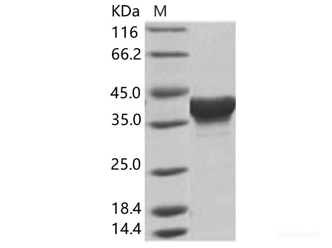 Recombinant EBOV (subtype Zaire, strain H.sapiens-wt/GIN/2014/Kissidougou-C15) Matrix protein VP40 Protein (His Tag)
