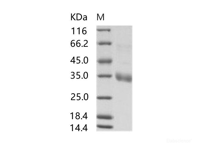 Recombinant MERS-CoV Spike/RBD Protein fragment (RBD, aa 367-606, His Tag)