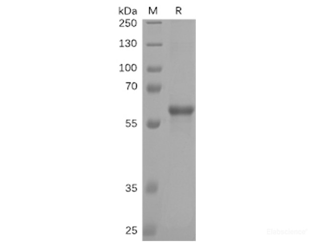 Recombinant SARS-CoV-2 (2019-nCoV) S protein RBD (C-mFc-6His tag)(Active)