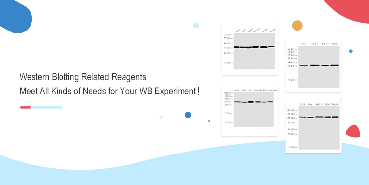Western Blot(WB) Related Reagents