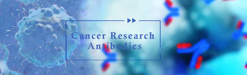 Cancer Research Antibodies