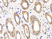 Galectin 3 Polyclonal Antibody