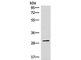 CDK4 Polyclonal Antibody