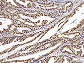 PETN Polyclonal Antibody