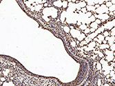 PETN Polyclonal Antibody