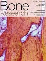 Research Spotlight | New Mechanism of Regulating Sensory Innervation In Bone