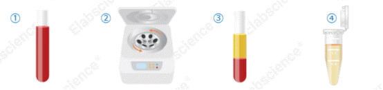 Serum sample processing workflow for ELISA, including centrifugation and storage steps.