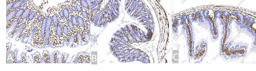 Vimentin/VIM antibody IHC analysis of human,mouse,and rat colon tissues.