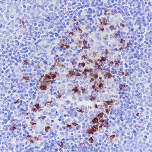 PD1 monoclonal antibody immunohistochemistry staining in paraffin-embedded human spleen tissue.