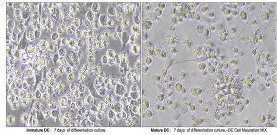 Morphology of bone marrow-derived dendritic cells (BMDCs) from C57BL/6 mice showing immature and mature DCs.