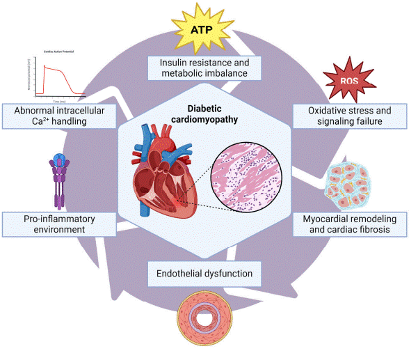Mitochondrial ROS in type 2 diabetes cardiomyopathy.