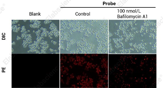 RAW264.7 cells showing reduced lysosomal activity after Bafilomycin A1 treatment.