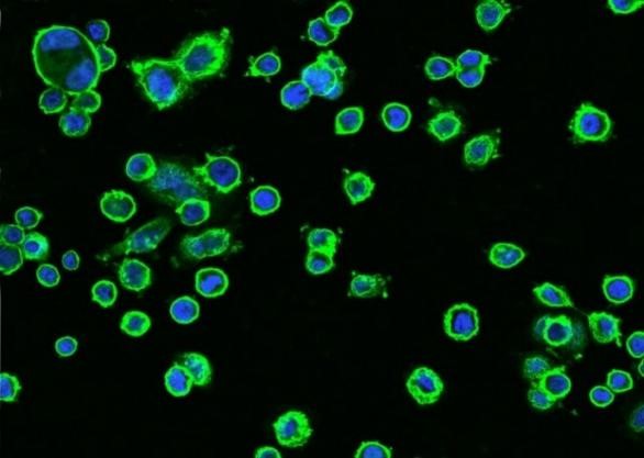 Immunofluorescence staining of Erbb2 in SKBR3 cells using recombinant rabbit monoclonal antibody.