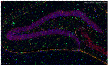 4-marker 5-color mIHC staining of mouse brain.