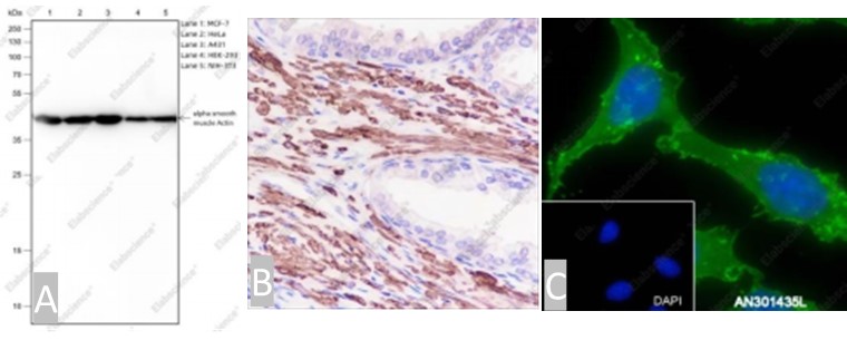 Alpha smooth muscle Actin antibody detection by WB,IHC,and IF in different samples.