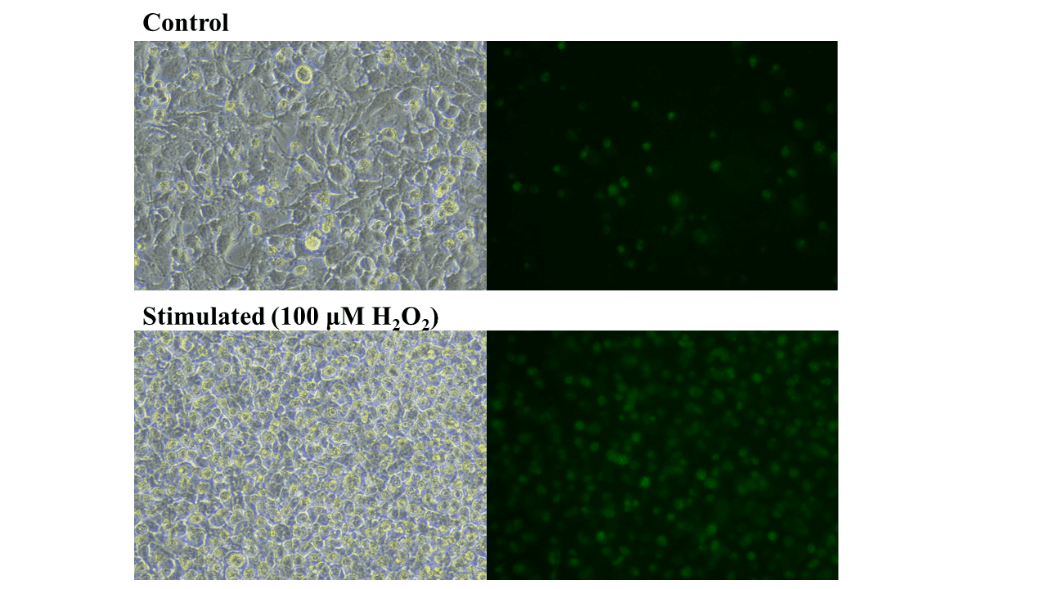 Fluorescence microscopy images of control and stimulated groups showing ROS.