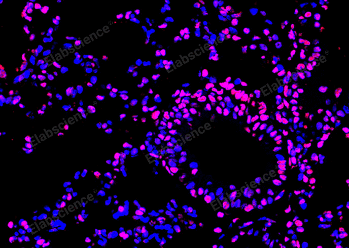 TUNEL staining analysis of apoptosis in paraffin-embedded mouse lung tissue.