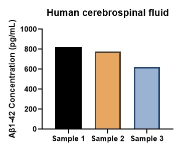 Human A&beta;1-42 concentration in cerebrospinal fluid measured using an ELISA kit.