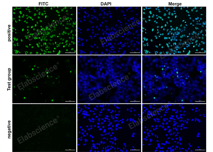 Fluorescence microscopy analysis of camptothecin-induced apoptosis in HeLa cells.