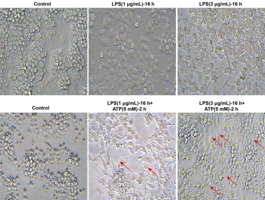 Morphological changes of pyroptosis in RAW264.7 cells.
