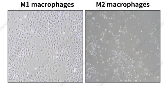 Morphology of M1- and M2-polarized BMDM.
